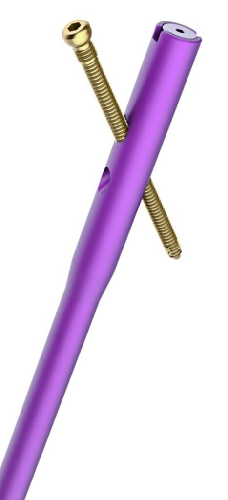 CLAVOS ENDOMEDULARES - vista 3