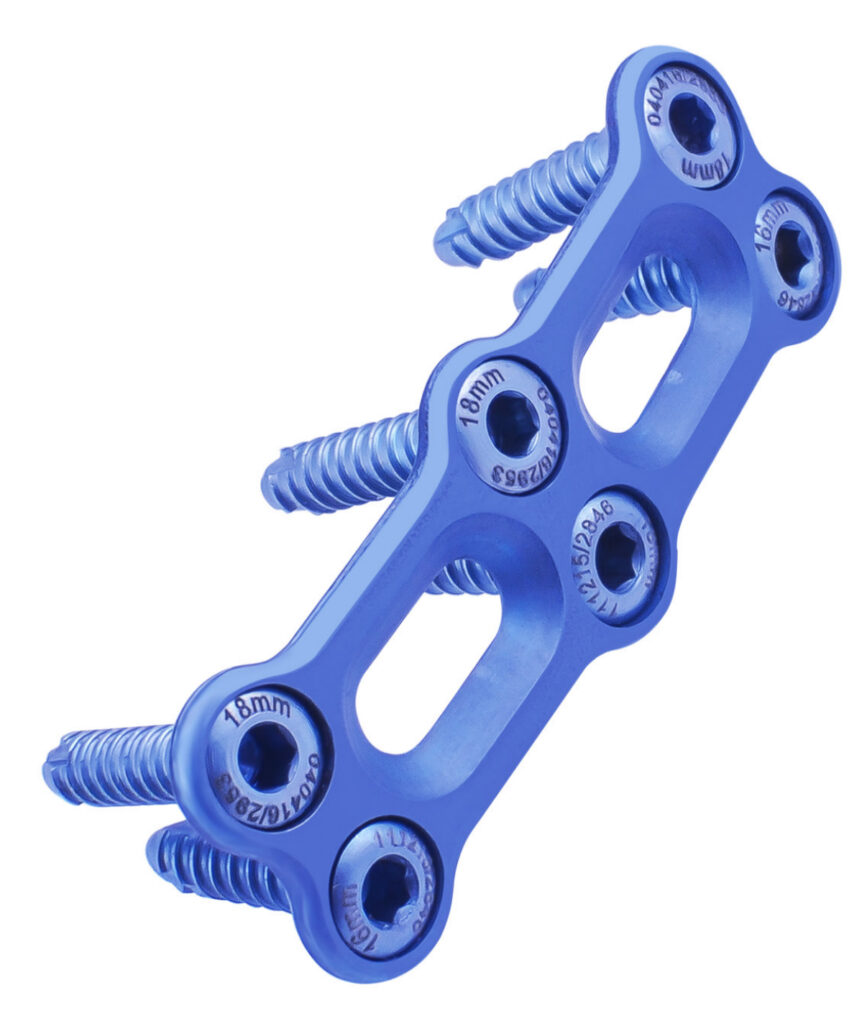 PLACA CERVICAL BLOQUEADA